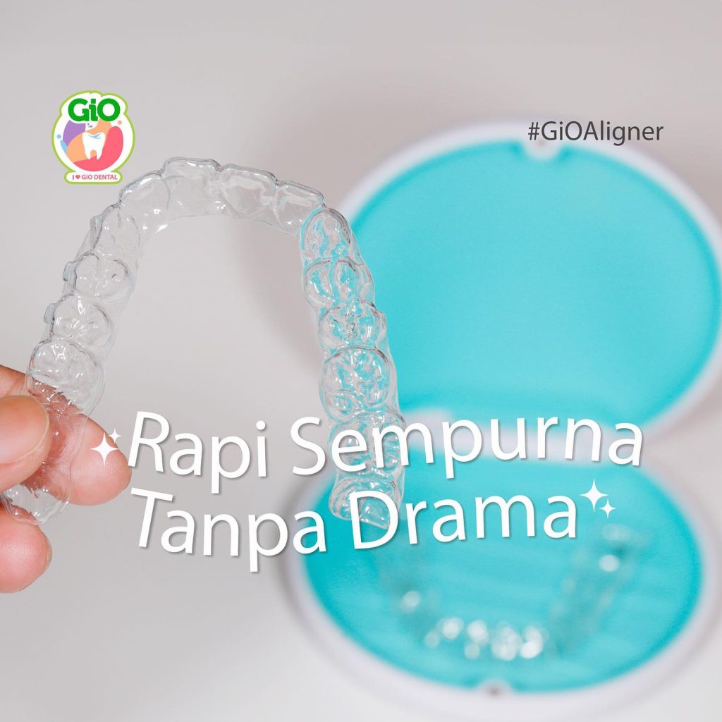 aligner gio semarang